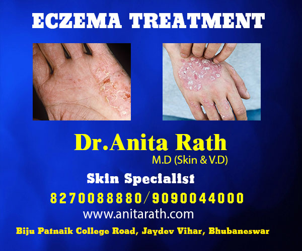 best skin treatment clinic in bhubaneswar near esi hospital